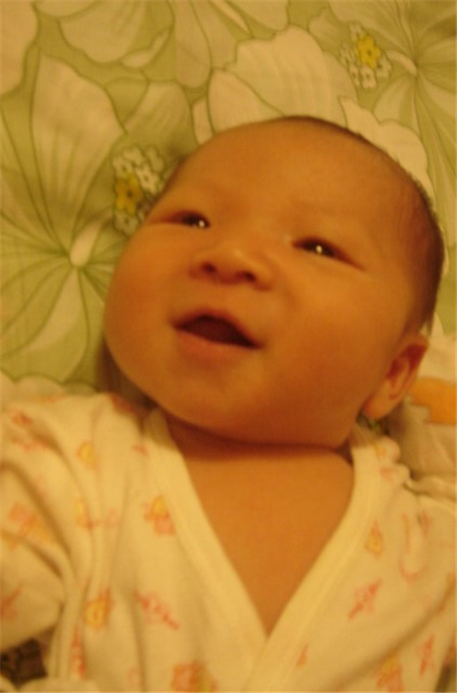 先天性喉喘鳴早期症狀