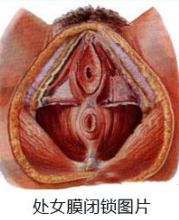 處女膜