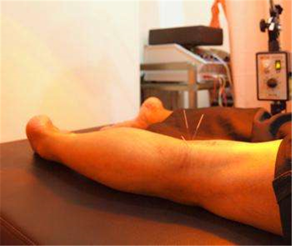 腦血栓針灸治療