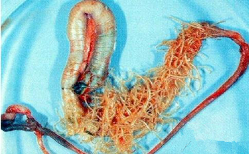 蛔蟲病症狀全解