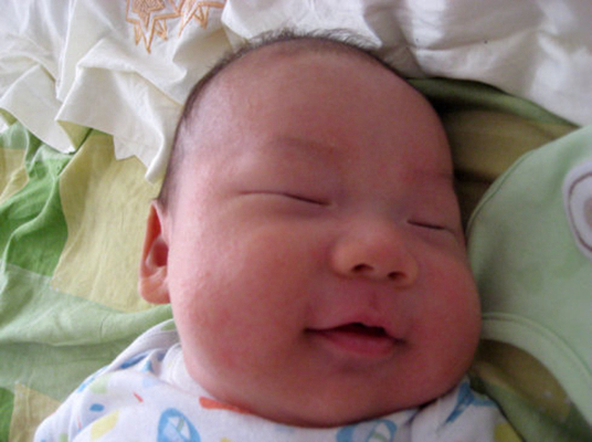 新生兒胎毒的症狀