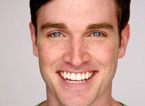 男人臉上長斑的