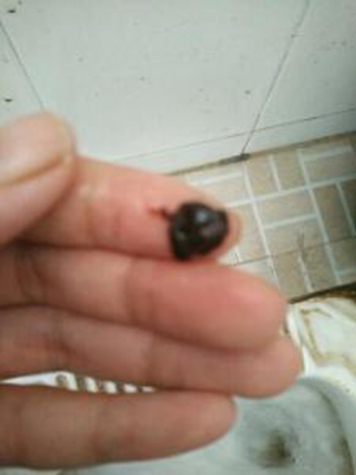 早孕藥流排出孕囊形狀