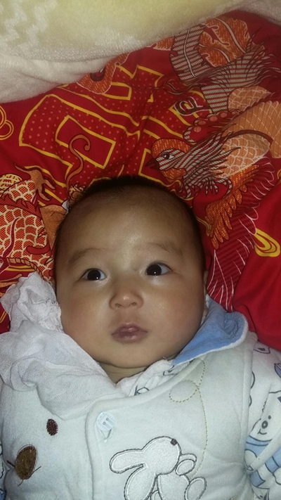 嬰兒嘴唇發紫 (9) 