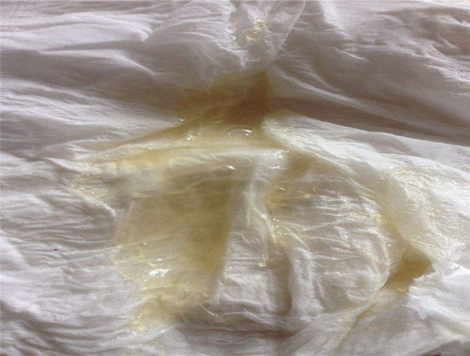 正常精子形態率是多少 