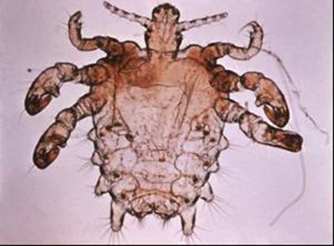 陰蝨蟲怎麼得的