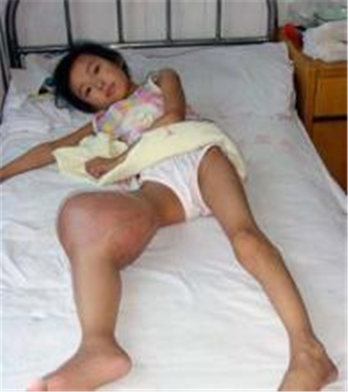 ff8636a9a3c57979ff50ef2c18f1fe57 