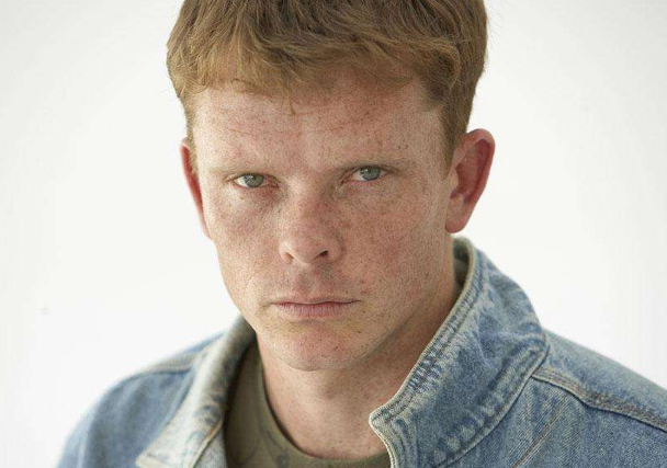 男人臉上長斑的