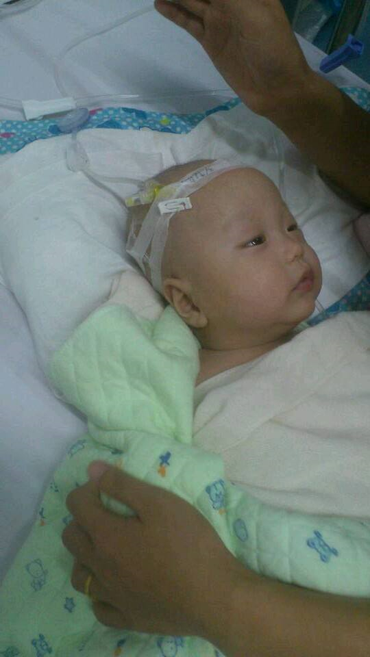 住院治療的腦積水患兒