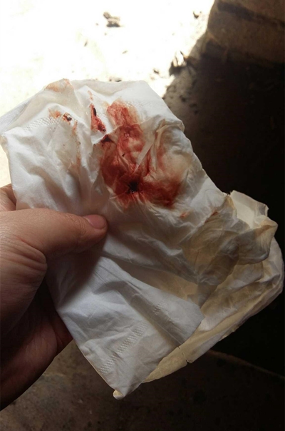 先兆流產分泌物