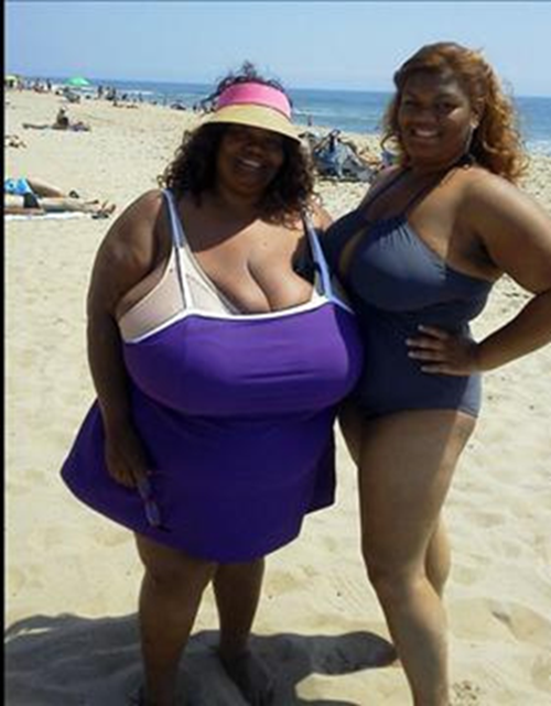 外國巨乳症患者生活