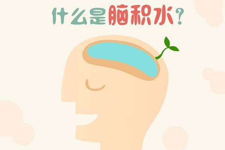 什麼是腦積水 