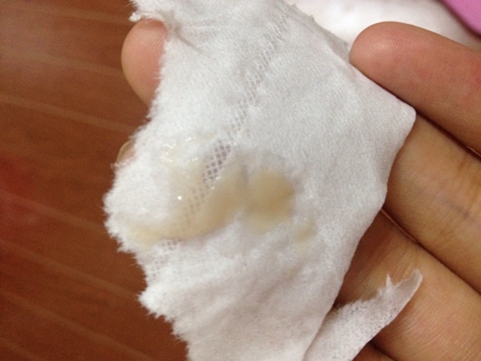 先兆流產分泌物