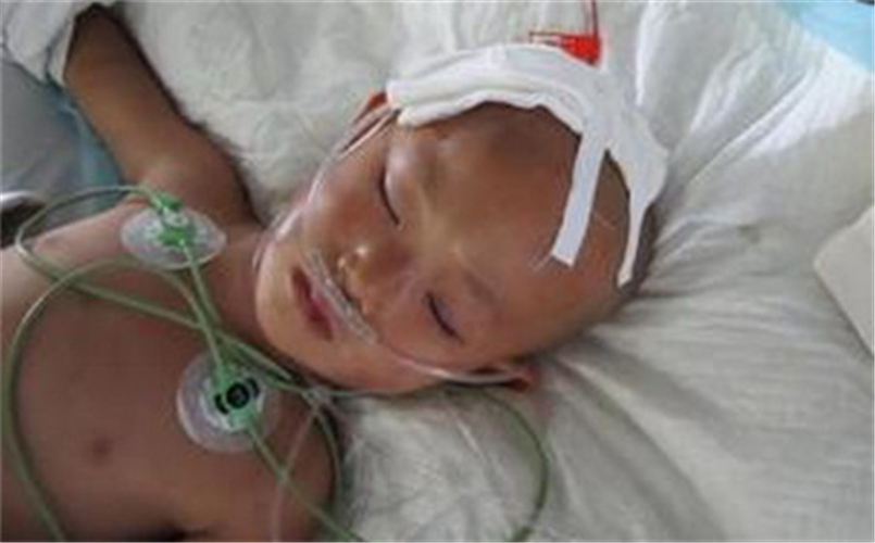 住院治療腦疝病