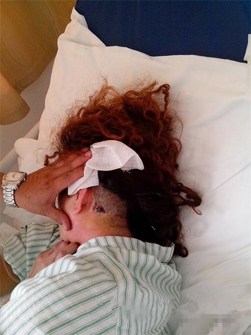 三叉神經痛中的治療